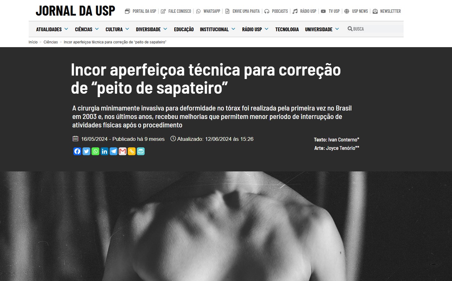 Incor aperfeiçoa técnica para correção de “peito de sapateiro”